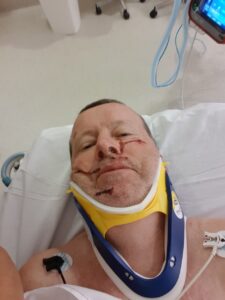 A patient in hospital after a bike crash